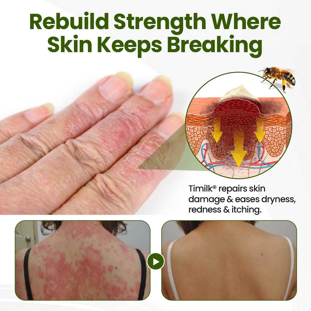 Timilk® BeePeptide RootSoft DualRelief Cream❤️‍🔥