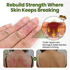 Timilk® BeePeptide RootSoft DualRelief Cream❤️‍🔥