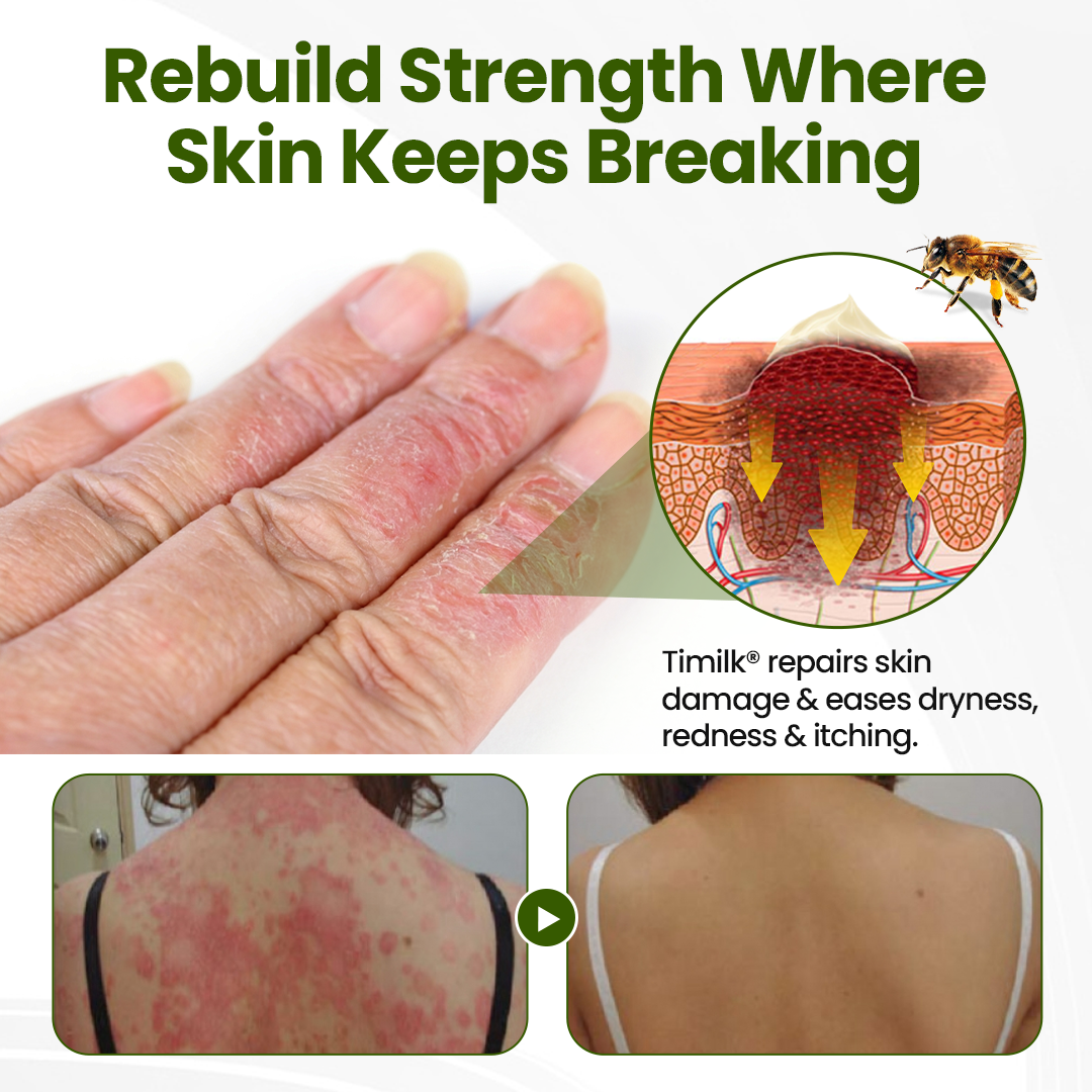 Timilk® BeePeptide RootSoft DualRelief Cream❤️‍🔥