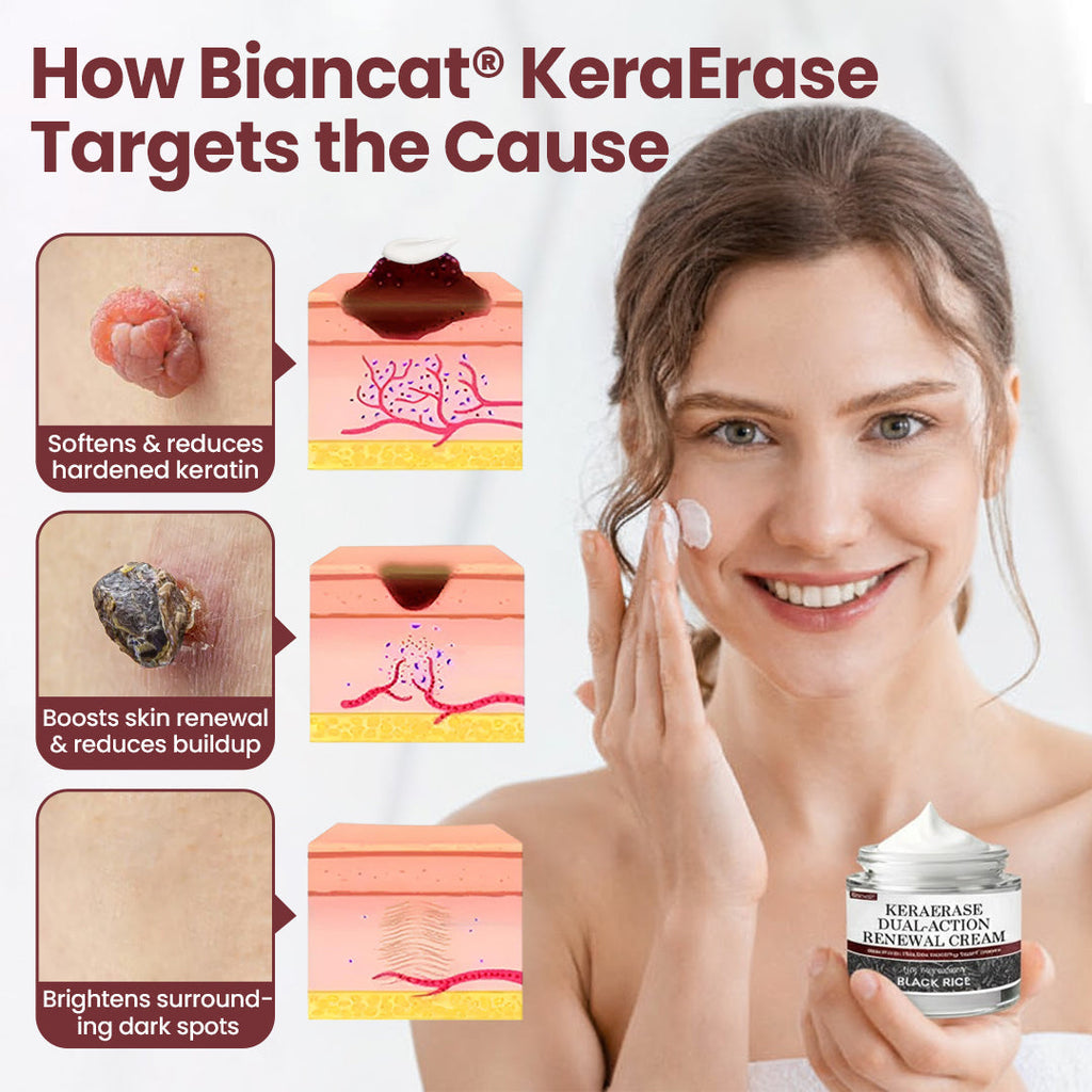 Biancat®KeraErase Dual-Action Renewal Cream✨