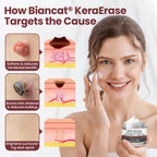 Biancat®KeraErase Dual-Action Renewal Cream✨