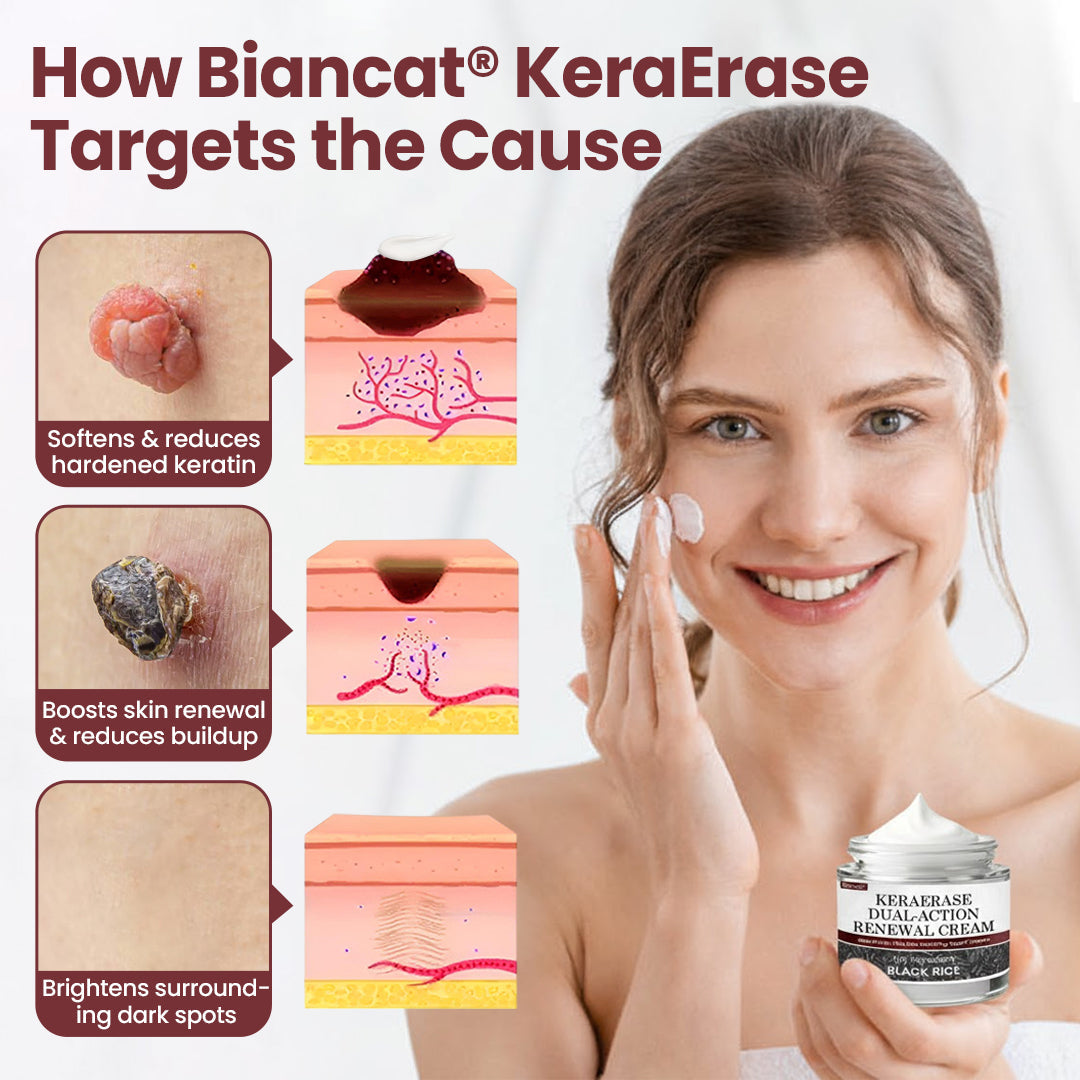 Biancat®KeraErase Dual-Action Renewal Cream✨