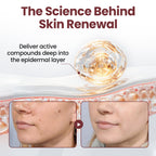 Biancat®KeraErase Dual-Action Renewal Cream✨