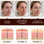 Biancat® Bee Venom Multi-Repair Cream 🔥