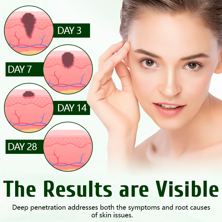 Timilk® DermaPure Tea Tree Healing Cream🔥