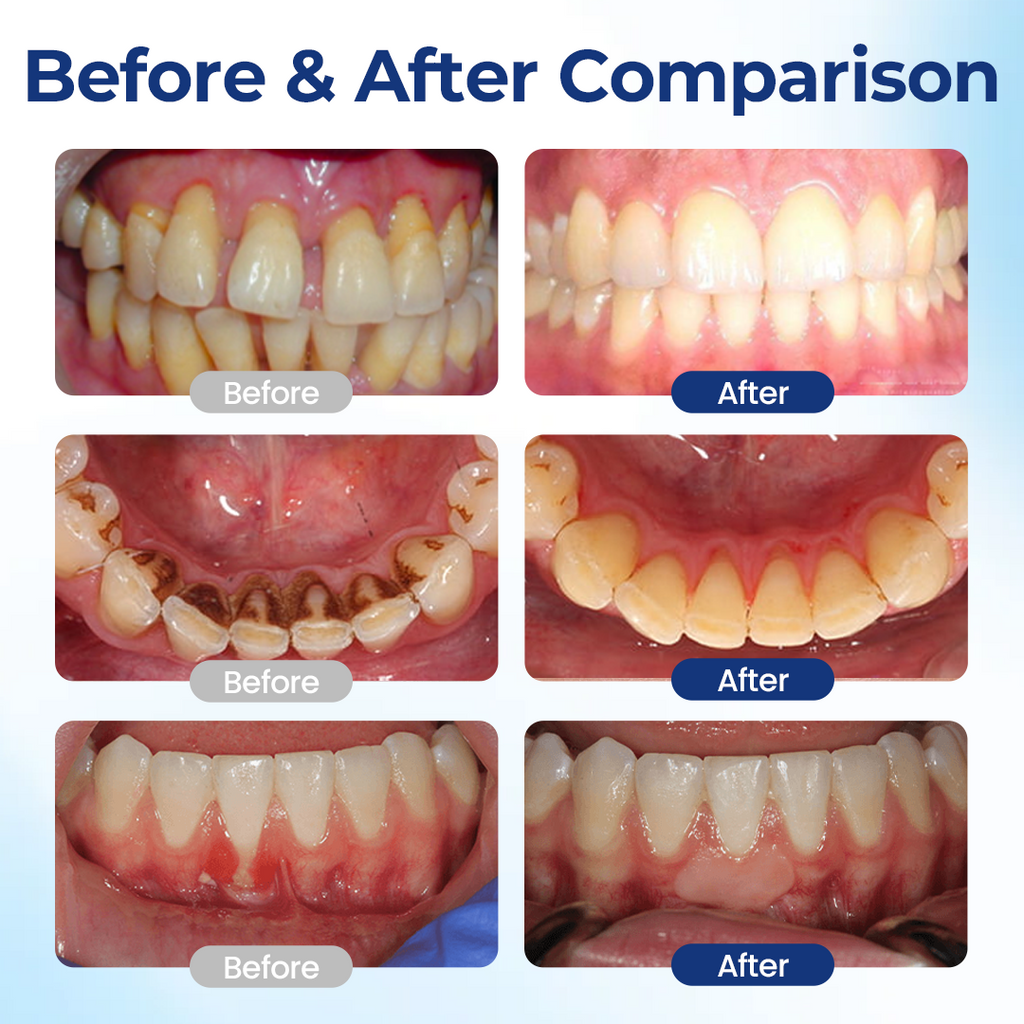 Biancat® BeeTakt Oral Repair Solution ✨