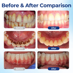 Biancat® BeeTakt Oral Repair Solution ✨