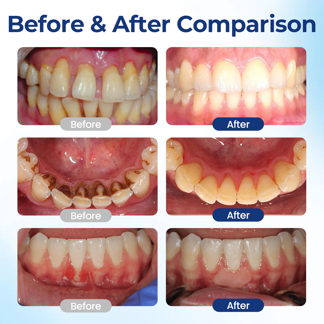 Biancat® BeeTakt Oral Repair Solution ✨