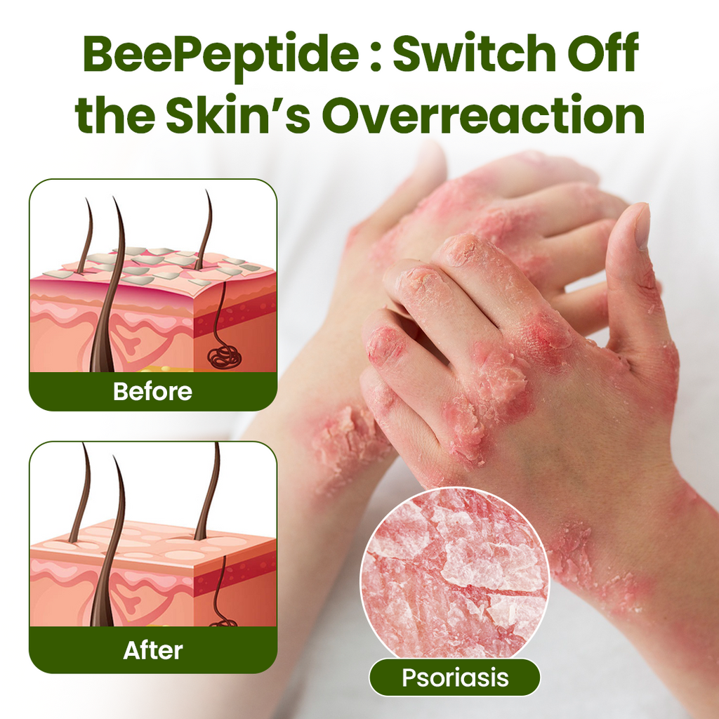 Timilk® BeePeptide RootSoft DualRelief Cream❤️‍🔥