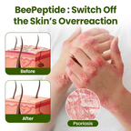 Timilk® BeePeptide RootSoft DualRelief Cream❤️‍🔥