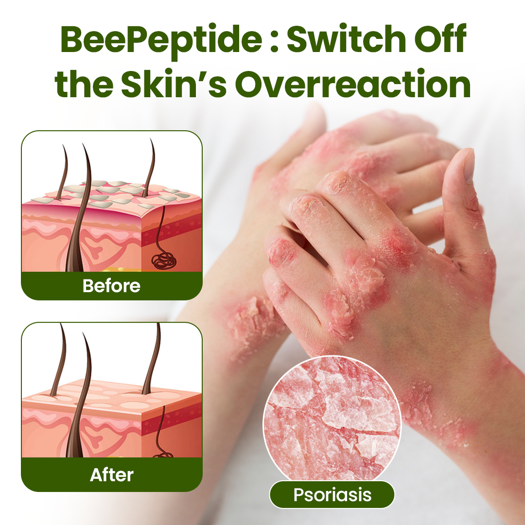 Timilk® BeePeptide RootSoft DualRelief Cream❤️‍🔥