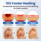 Timilk® GlucoDerm Barrier Spray✨