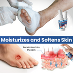 Timilk® GlucoDerm Barrier Spray✨