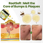 Timilk® BeePeptide RootSoft DualRelief Cream❤️‍🔥