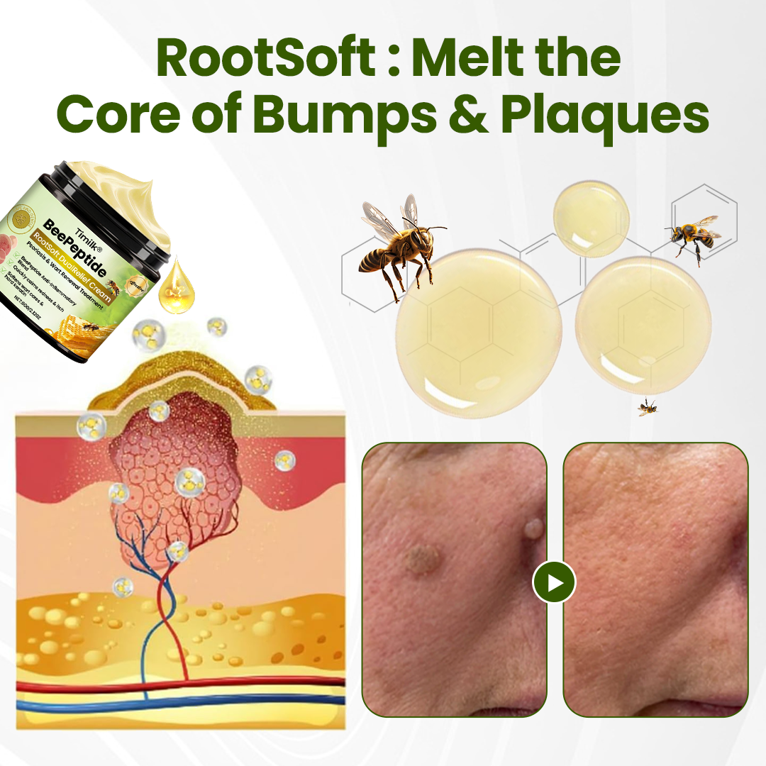 Timilk® BeePeptide RootSoft DualRelief Cream❤️‍🔥