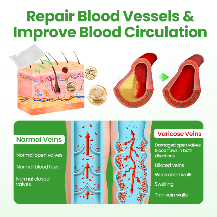 Healrize® VeinHeal Microneedle Patch